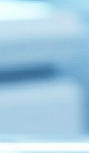 돌출입 교정 기간 줄일 수 있을까? 기간 단축을 돕는 핵심 요소 관련 이미지 36