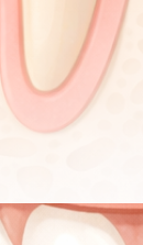 압구정 교정 치과 정밀 진단이 중요한 이유? 관련 이미지 26