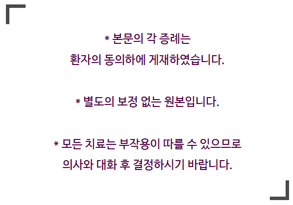 크라운 치료 가격 신경치료 후 크라운 꼭 해야 할까요? 관련 이미지 3