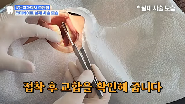 앞니 라미네이트 가격 00만 원? 진짜 중요한 건 따로 있어요 관련 이미지 6