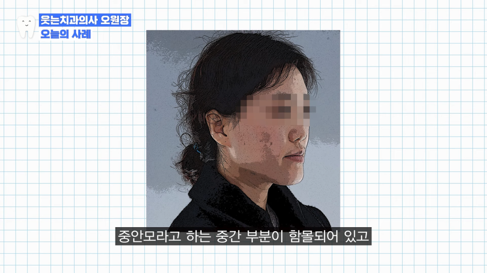 주걱턱 치아교정? 효과적인 주걱턱 교정 시기는 언제 관련 이미지 3
