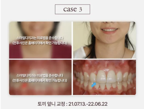 [안내] 스마일디치과의원입니다 관련 이미지 4