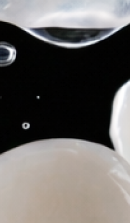 서울교정치과 선택 전 확인해야 할 정밀 진단 기준 관련 이미지 28