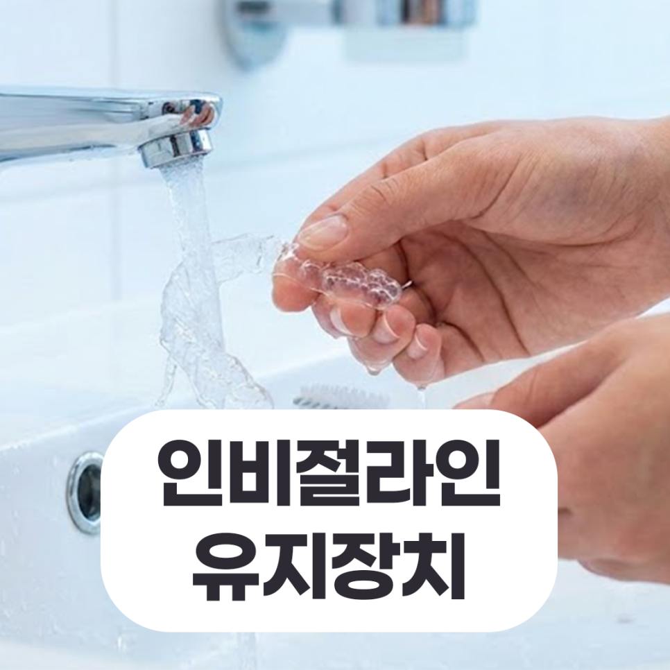 Invisalign Retainer Duration: A Detailed Look image 1