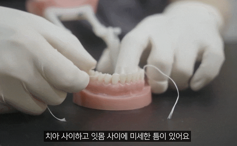 Flossing Order: Before Brushing? After? The Correct Way to Use Dental Floss image 3