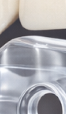 40대 치아 교정 고민 중이라면? 부담 줄이고 효율 높이는 선택법 관련 이미지 29