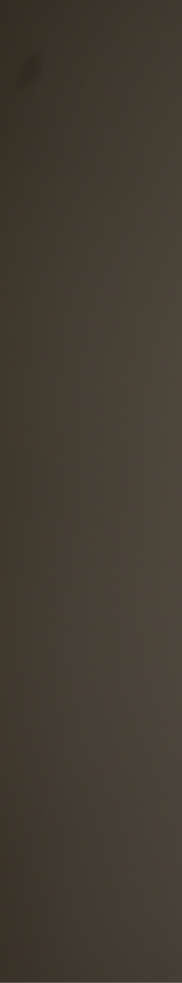 네비게이션 임플란트 식립과정 정확한 계획이 중요한 이유 관련 이미지 18