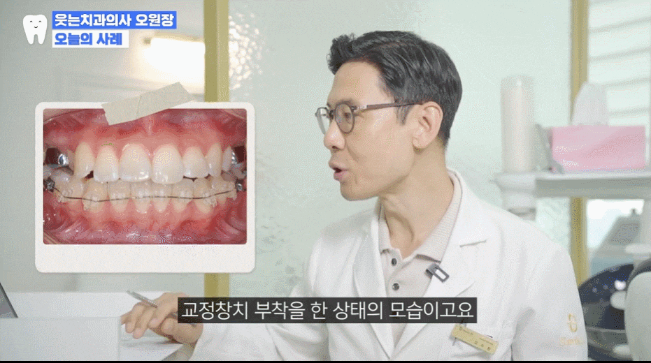 재교정 비용, 첫 교정보다 비싼 진짜 이유 (두 번 실패하지 않는 법) 관련 이미지 6