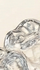 Gangnam Dental Clinic Orthodontics: Is Treatment Possible for Adults? image 32