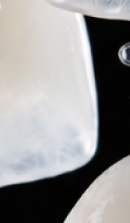 서울교정치과 선택 전 확인해야 할 정밀 진단 기준 관련 이미지 26