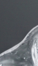 강남교정치과 선택 시 확인해야 할 핵심 기준과 정밀 진단 관련 이미지 35