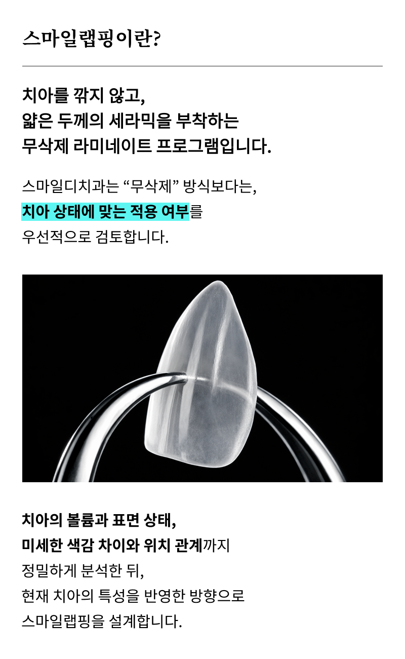 무삭제 라미네이트 시술 전 알아봐야 할 목록? 관련 이미지 8