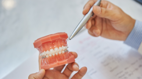 Key Points You Need to Know About Orthodontic Treatment Costs and Non-Extraction Orthodontics image 8