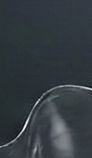 신사역치과 치아교정 전 꼭 확인해야 할 정밀 진단 기준 관련 이미지 28