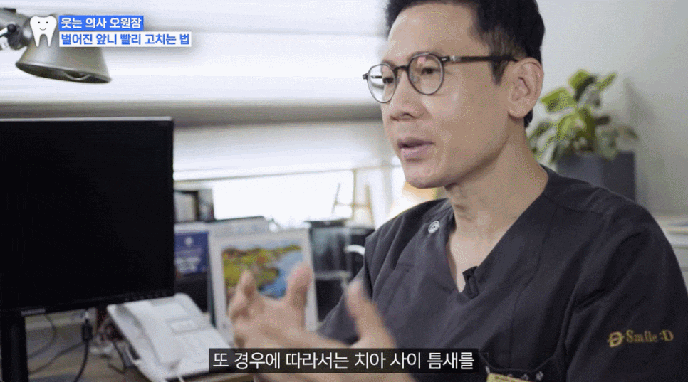 Front teeth gaps? Here are 3 solutions after adult orthodontic treatment image 7