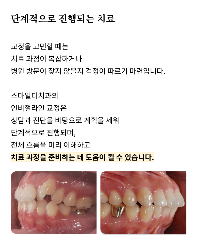 논현역교정치과 선택 전 반드시 확인해야 할 체크 포인트 관련 이미지 18