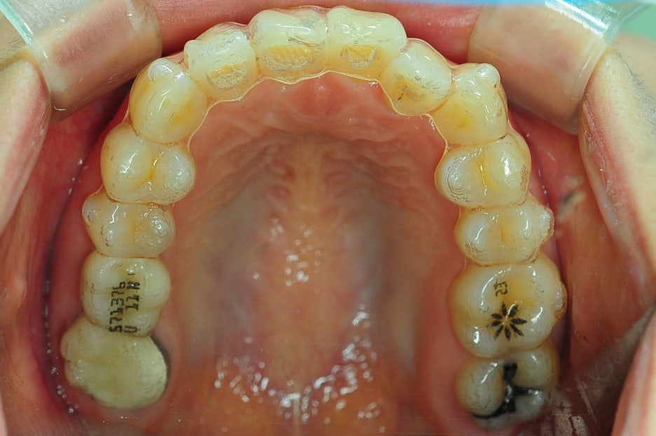 Invisalign Dentistry: What About This Place? Read This Before Asking image 8