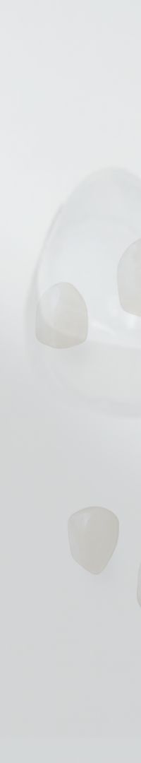 Things to Keep in Mind When Searching for a Laminate Dentistry Clinic Near Sinsa Station image 22