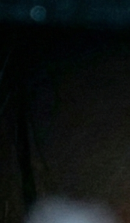 논현역교정치과 선택 전 반드시 확인해야 할 체크 포인트 관련 이미지 24