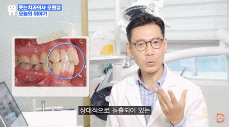 무턱교정 전후 사진만 찾아보고 있다면 반드시 확인해야 할 것들 관련 이미지 6