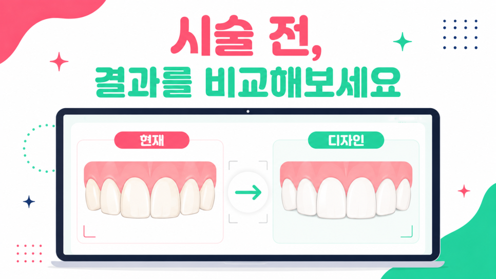강남 라미네이트, 무삭제만 보고 결정하면 안 되는 이유 관련 이미지 7