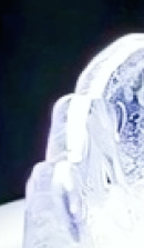 강남 임플란트 치과 초기 단계의 정밀한 분석이 중요한 이유 관련 이미지 27