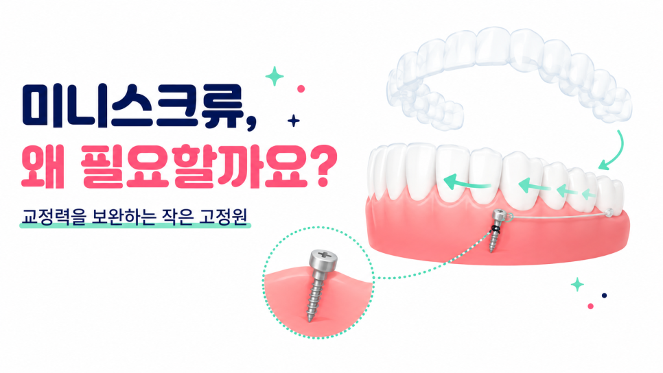 Before Choosing an Orthodontic Clinic in Seoul, Take a Look at the Appliances and Screws image 8