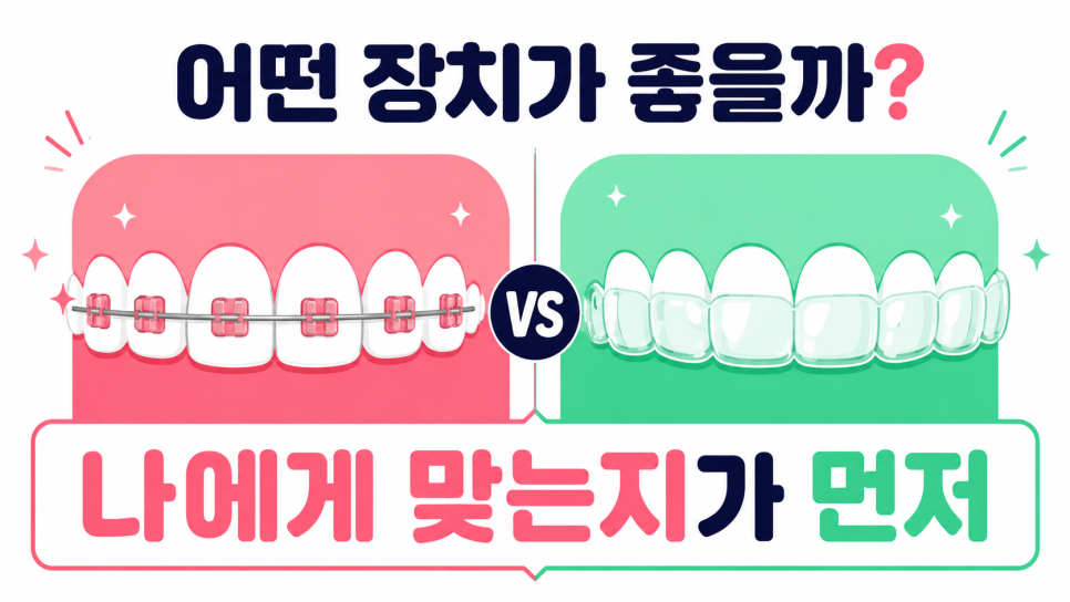 강남교정치과, 교정 종류보다 먼저 살펴야 할 선택 기준은? 관련 이미지 6