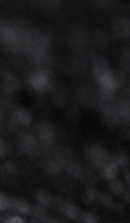 Curious About the Minimal-Preparation Laminate Procedure? image 33