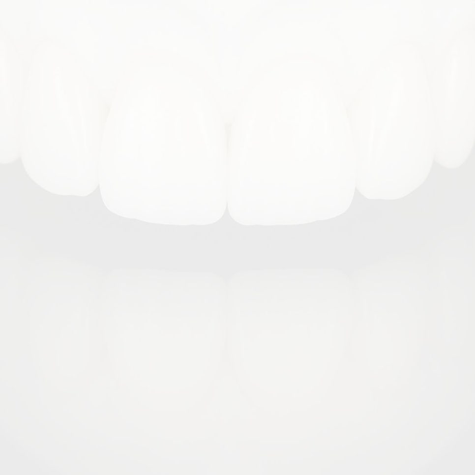 어린이 부정교합, 무턱 교정은 &lsquo;성장기 타이밍&rsquo;이 중요해요 관련 이미지 35