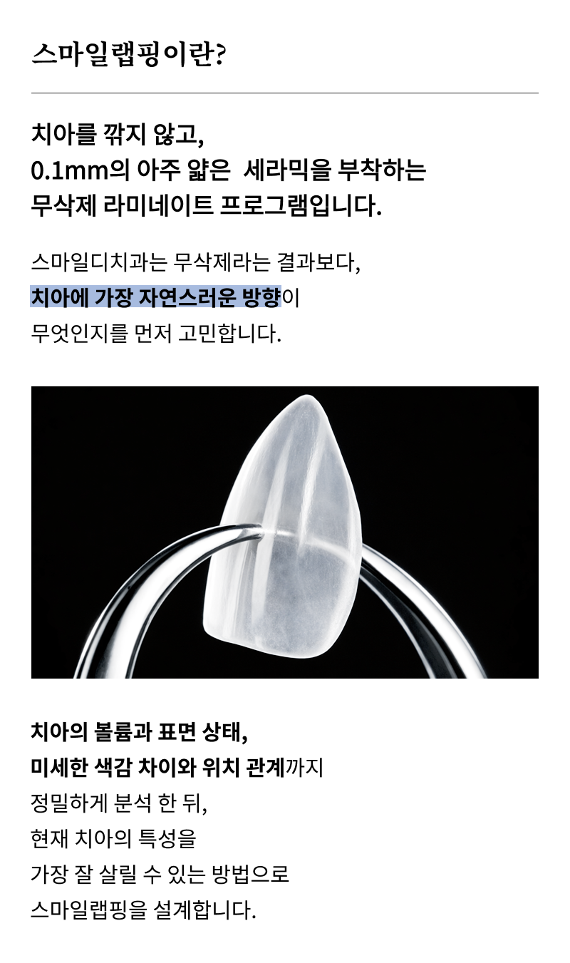 앞니 벌어짐 치료 전 반드시 체크해야 할 것들 정리 관련 이미지 10