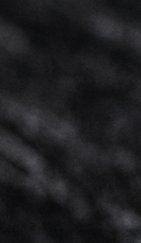 Curious About the Minimal-Preparation Laminate Procedure? image 32