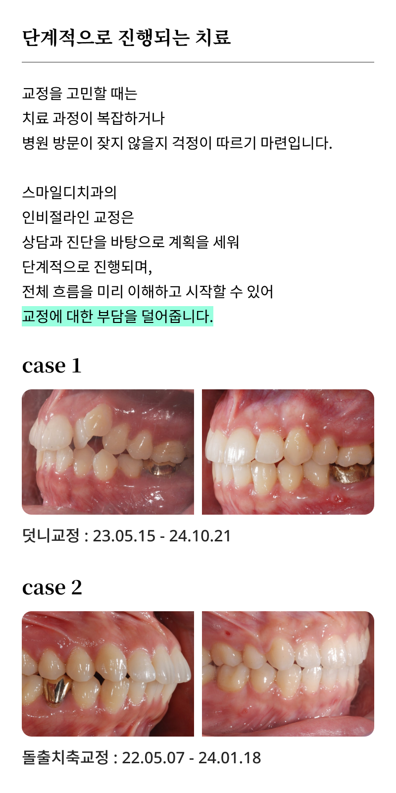 강남교정치과 선택 시 확인해야 할 핵심 기준과 정밀 진단 관련 이미지 15