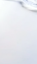 강남 임플란트 치과 초기 단계의 정밀한 분석이 중요한 이유 관련 이미지 39