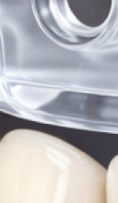 40대 치아 교정 고민 중이라면? 부담 줄이고 효율 높이는 선택법 관련 이미지 36