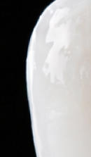 서울교정치과 선택 전 확인해야 할 정밀 진단 기준 관련 이미지 23