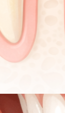 압구정 교정 치과 정밀 진단이 중요한 이유? 관련 이미지 25