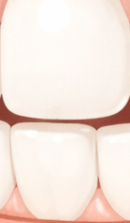 잠원역교정치과 선택 전 확인해야 할 의학적 진단 기준 관련 이미지 31