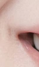 서울라미네이트치과 알아보고 있다면 관련 이미지 27