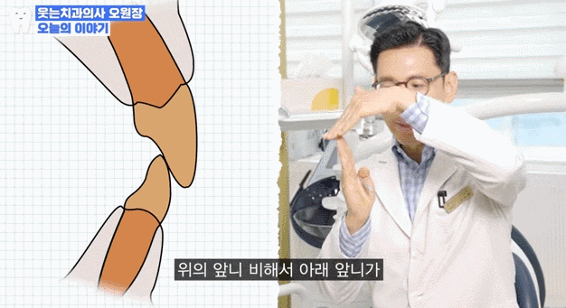 무턱교정 전후, 얼굴라인 달라지고 싶다면 관련 이미지 10