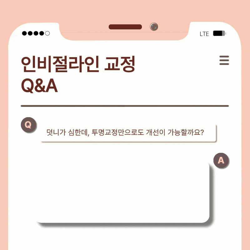 압구정치과 치아교정 고민하고 있다면 관련 이미지 20