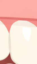 신사역 치과 추천 찾아본다면 관련 이미지 29