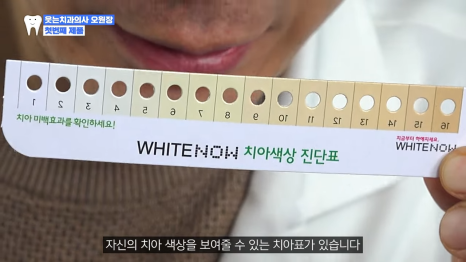 Is the price of in-clinic teeth whitening really worth it? A direct comparison with self-whitening image 7