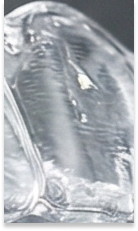 강남교정치과 선택 시 확인해야 할 핵심 기준과 정밀 진단 관련 이미지 33