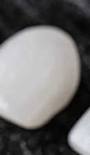 Curious About the Minimal-Preparation Laminate Procedure? image 39