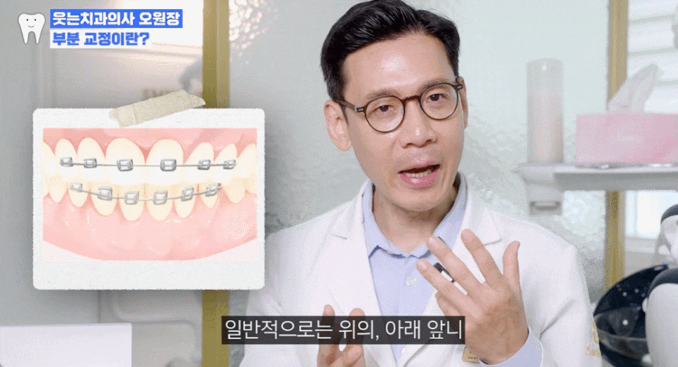 나비 앞니 교정 관련 이미지 2