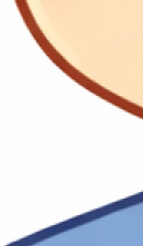 앞니 라미네이트 시술이 고민된다면 관련 이미지 40