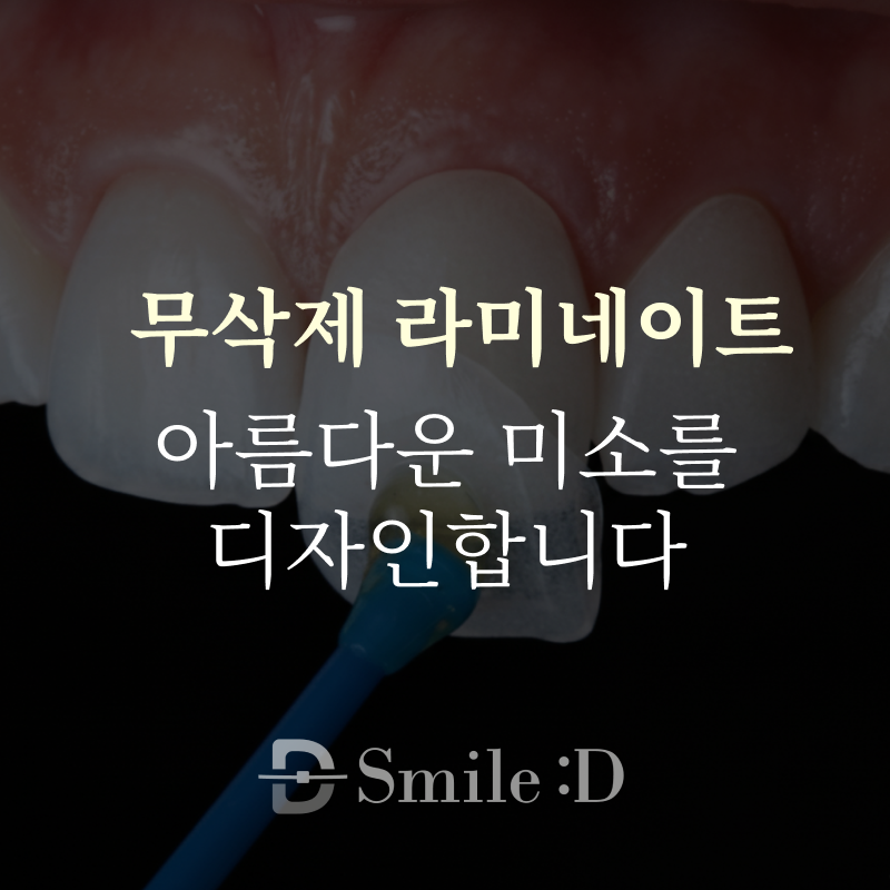 What should you be sure to check before deciding on Gangnam laminate dentistry? image 1