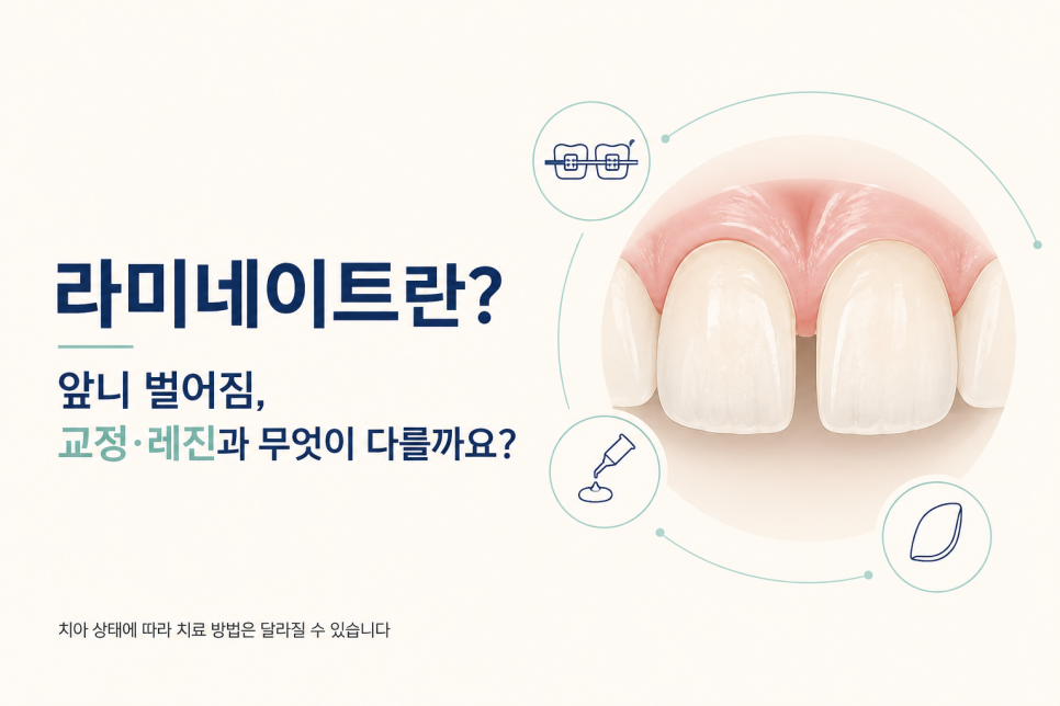 라미네이트란? 앞니 벌어짐 고민, 교정·레진과는 어떻게 다를까 관련 이미지 1
