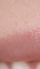 What should you be sure to check before deciding on Gangnam laminate dentistry? image 26